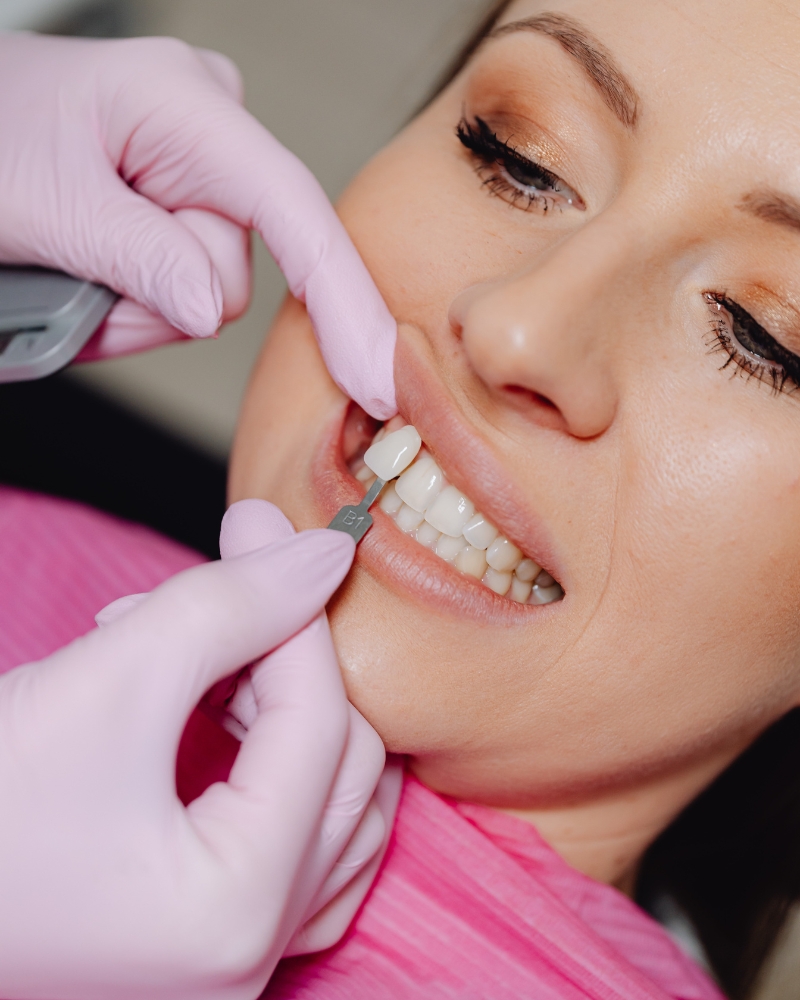 Imagen Estética Dental