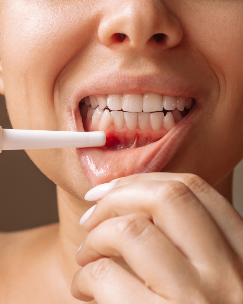 Imagen Periodoncia