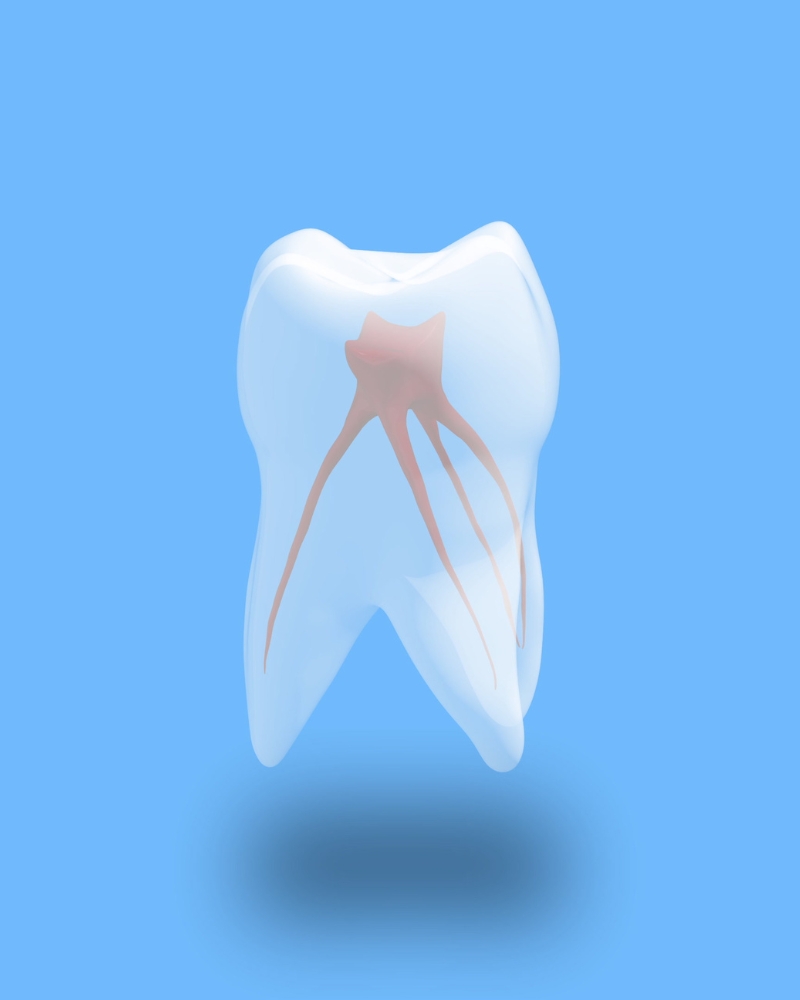 Imagen Endodoncia
