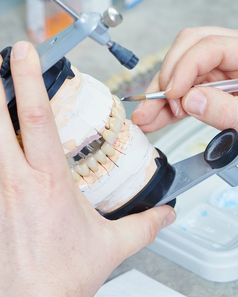 Imagen Prótesis Dental
